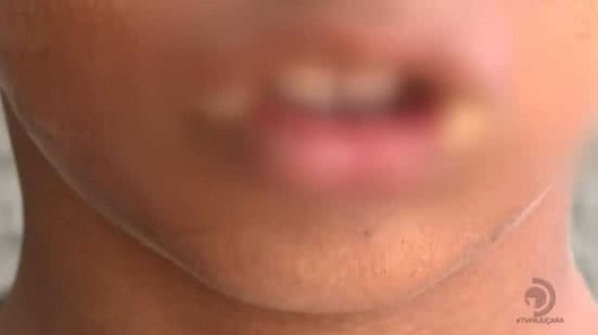 A criança tem 9 anos, tem Transtorno do Espectro Autista (TEA) e está internada - Reprodução/TV Pajuçara