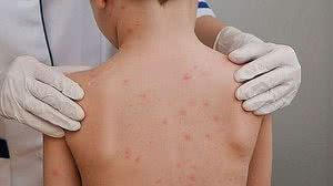 Foto: Ilustrativa/Arquivo TNH1