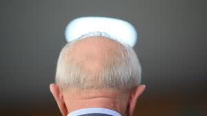 Lula vai passar por novo procedimento cirúrgico para bloquear fluxo de sangue no cérebro - Fotoarena / Folhapress