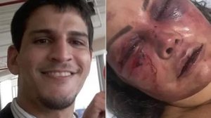 Imagem Homem que espancou paisagista é absolvido após diagnóstico de parassonia; entenda distúrbio