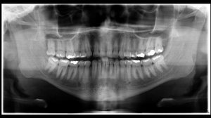 Ascom Polícia Científica