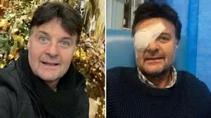 Ator perde a visão após ser atacado no trânsito de Londres - Reprodução / Instagram