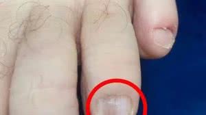 Foto: Reprodução/The Sun