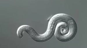 Foto: LiveScience/Centro de Controle e Prevenção de Doenças (CDC)