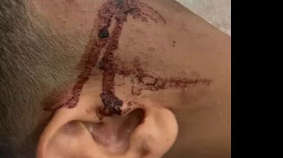 Aluno fica cego após brincadeira com barra de ferro em escola - Reprodução / Redes sociais