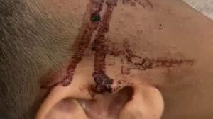 Aluno fica cego após brincadeira com barra de ferro em escola - Reprodução / Redes sociais