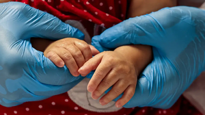 Doença é rara, atingindo menos de 65 pessoas a cada 100 mil indivíduos - Foto: Agência Brasil