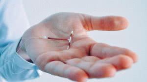 Método tem 99% de eficácia. - Foto: Ascom Saúde