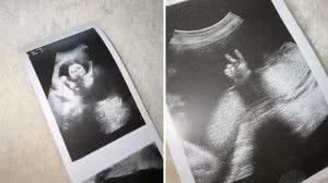 Foto: Reprodução/Redes Sociais