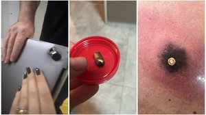 Ladrão atira nas costas de motociclista durante assalto e notebook na mochila impede ferimento grave na vítima - Foto: Divulgação/PM