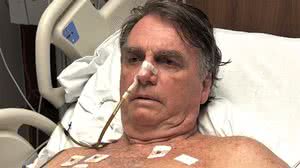 Imagem Bolsonaro apresenta “piora clínica” e pressão arterial elevada, diz boletim