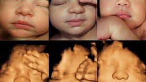 Foto: Reprodução/Redes Sociais