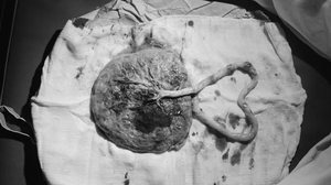 Foto: Reprodução/Unplash