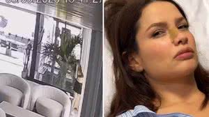 Juliette sofre acidente doméstico e fratura o nariz - Reprodução / Instagram