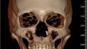 Foto: Reprodução/Arquivo Pessoal