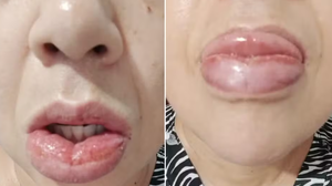 Imagem Anvisa volta a interditar pasta de dente da Colgate após marca retirar recurso