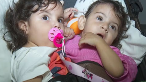 Gêmeas passam por cirurgia de separação, em Goiás - Foto: Reprodução/TV Anhanguera