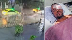 Tampa solta de bueiro faz carro 'voar' e taxista perde a visão de um olho - Reprodução / TV Globo