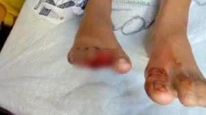 Foto: Correio Braziliense