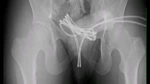 Foto: Reprodução/Cureus/Reprodução