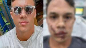 Imagem Personal trainer defende mulheres de assédio, é agredido com copo de vidro e leva 45 pontos no rosto