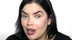 Ana Paula passou a sofrer de condição rara após levar um choque em um poste no Corredor Vera Arruda, em Maceió - Foto: Reprodução/TV Pajuçara