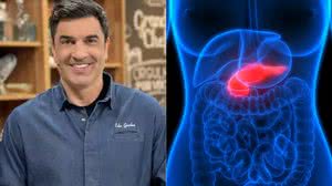 Imagem Tumor no pâncreas: saiba mais sobre a doença que fez Edu Guedes passar por cirurgia