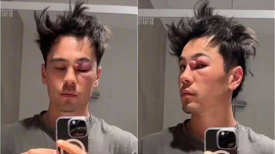 Reprodução/Redes sociais