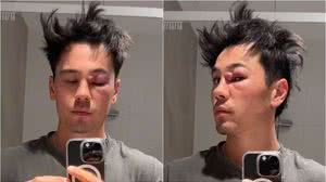 Reprodução/Redes sociais