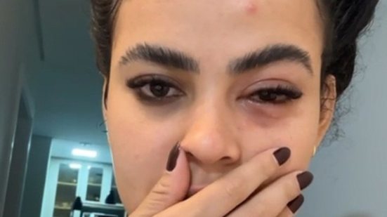 Influenciadora viraliza após ter infecção no olho causada por mosca de banheiro no Espírito Santo - Foto: Reprodução/ Redes Sociais