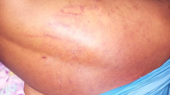 Imagem Polícia investiga agressão envolvendo a Guarda Municipal de São José da Laje