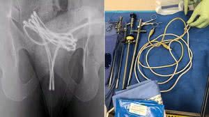 Reprodução/ Cureus