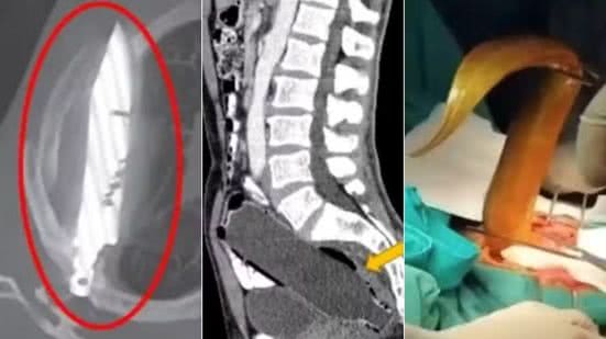 Reprodução/Clinical Case Reports/Viet Duc Hospital