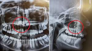 Foto: Reprodução/Newsweek