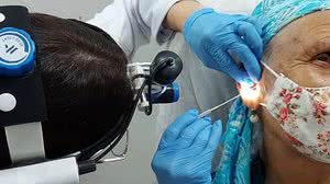 Foto: Reprodução/Projeto Cercúmen