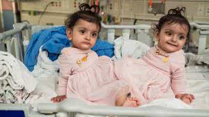 Foto: Seattle Children's Hospital