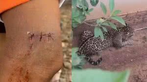 Fábio Diniz/Rede Amazônica