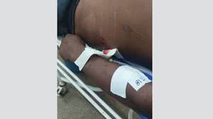 Homem ferido com uma flecha é socorrido no Amazonas - Reprodução / Redes sociais