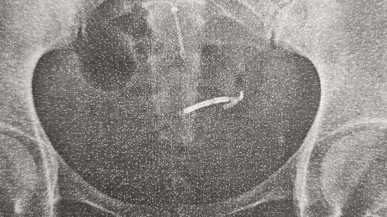 Foto: Reprodução/Arquivo Pessoal