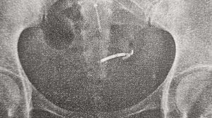 Foto: Reprodução/Arquivo Pessoal