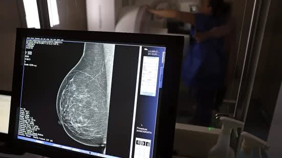 Ministério da Saúde passa a recomendar mamografia a partir dos 40 anos - José Cruz / Agência Brasil