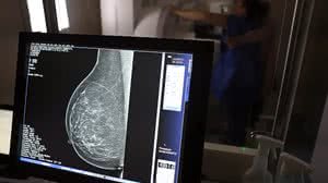 Ministério da Saúde passa a recomendar mamografia a partir dos 40 anos - José Cruz / Agência Brasil