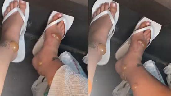 Foto: Reprodução/Redes Sociais