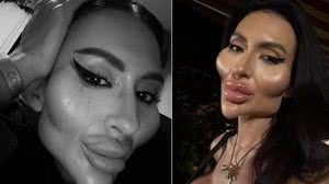 Imagem Mulher com as maiores maçãs do rosto no mundo mostra incrível transformação física