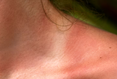 Foto: Reprodução/Freepik