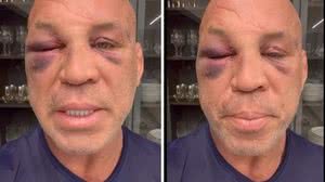 Reprodução/Redes sociais