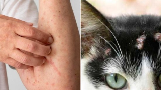 Lesões na pele que não cicatrizam após contato com gatos ou materiais vegetais podem ser esporotricose: procure atendimento médico. - Foto: Reprodução Internet