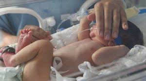 Bebê é cuidado em uma incubadora de UTI neonatal - Fabio Rodrigues Pozzebom / Agência Brasil