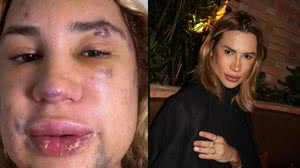 Foto: Reprodução/Redes Sociais