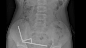 Divulgação / New Zealand Medical Journal